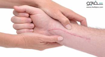 عفونت زخم جراحی - surgical wound infection عفونت زخم جراحی - surgical wound infection