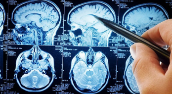 مشخصات بهترین جراح مغز و اعصاب ، هیپوفیز و تومور مغزی مشخصات بهترین جراح مغز و اعصاب ، هیپوفیز و تومور مغزی