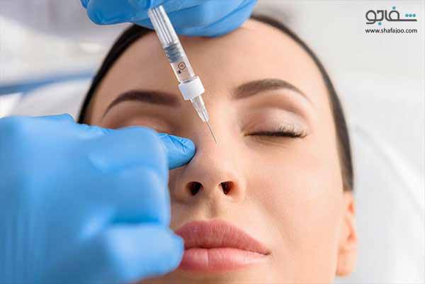 چگونه بدون جراحی بینی زیبا داشته باشیم؟